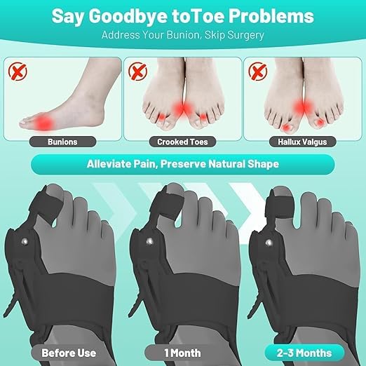 Bunion Corrector for Women and Men Big Toe,Upgraded Press-Button Bunions Correction,Toe Straightener with Bunion Relief,Suitable for Left and Right Feet,Large,Black 1Pack - Open Box